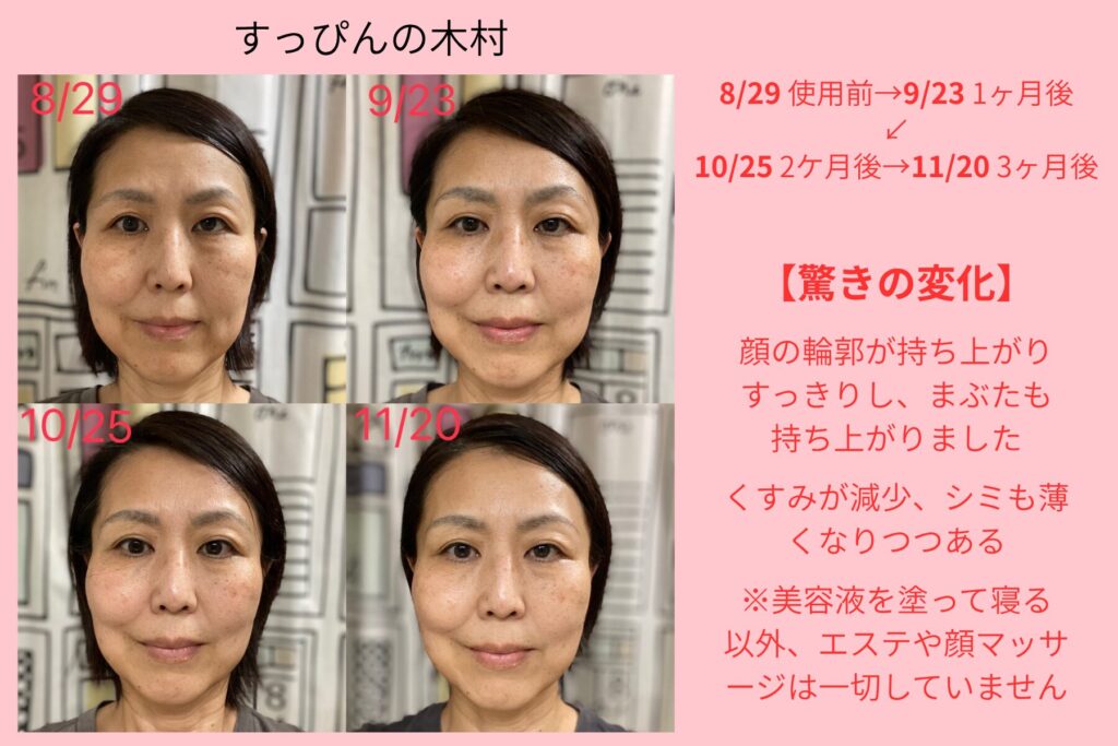 私のお気に入り】美容液マヒナ